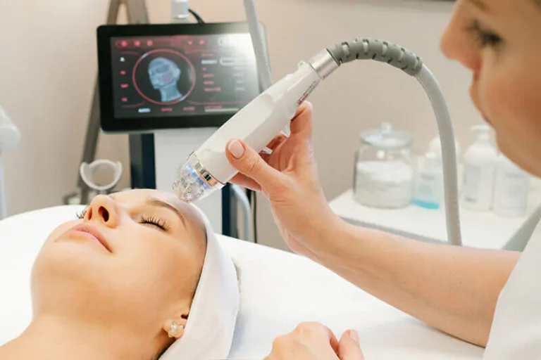 Радіорефракційний мікроголковий радіочастотний ліфтинг без скальпеля